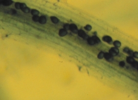 Ectomycodrrhiza Fungi- Mircroscopic view of AM fungus, the dark masses inside the cell of this clover root are vesicules.