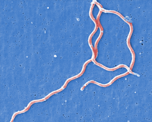 electron micrograph of Borrelia burgdorferi cells, which look like extended coils.